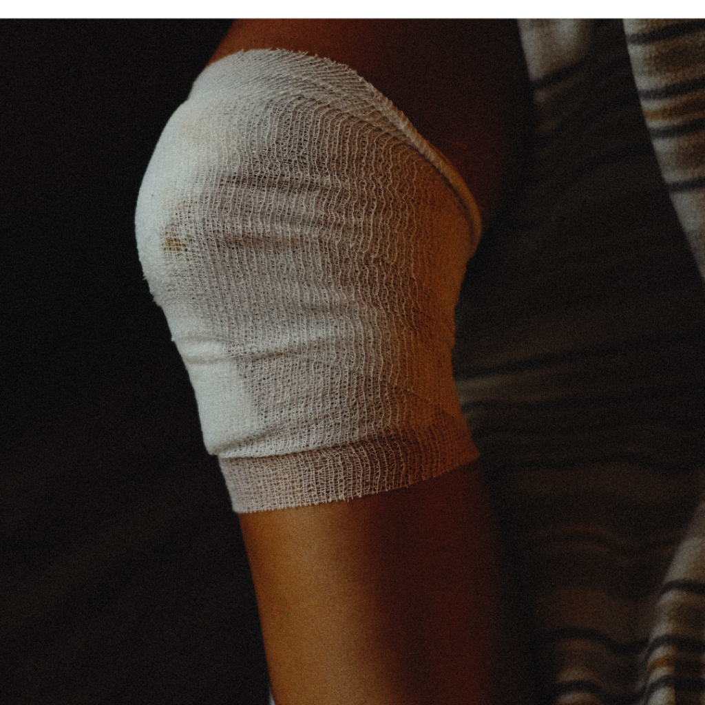 Person with Medical Gauze Bandage on Injured Knee