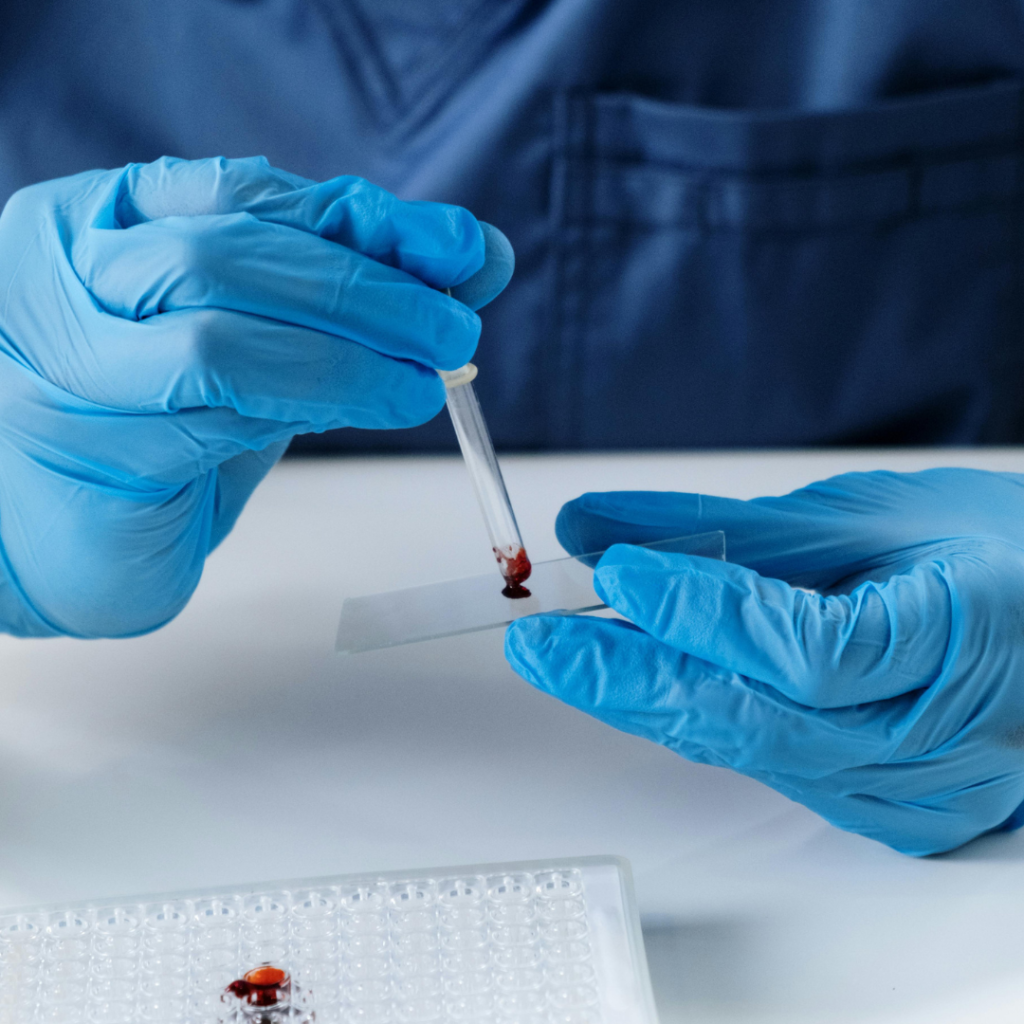 A Person Placing a Blood Sample on a Microscope Slide