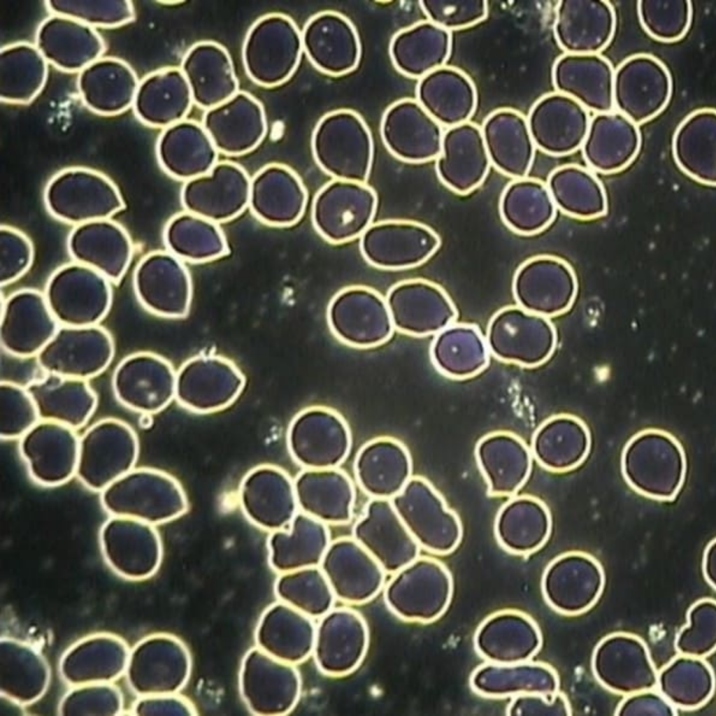 Free-flowing blood cells after being exposed to quantum energy technology